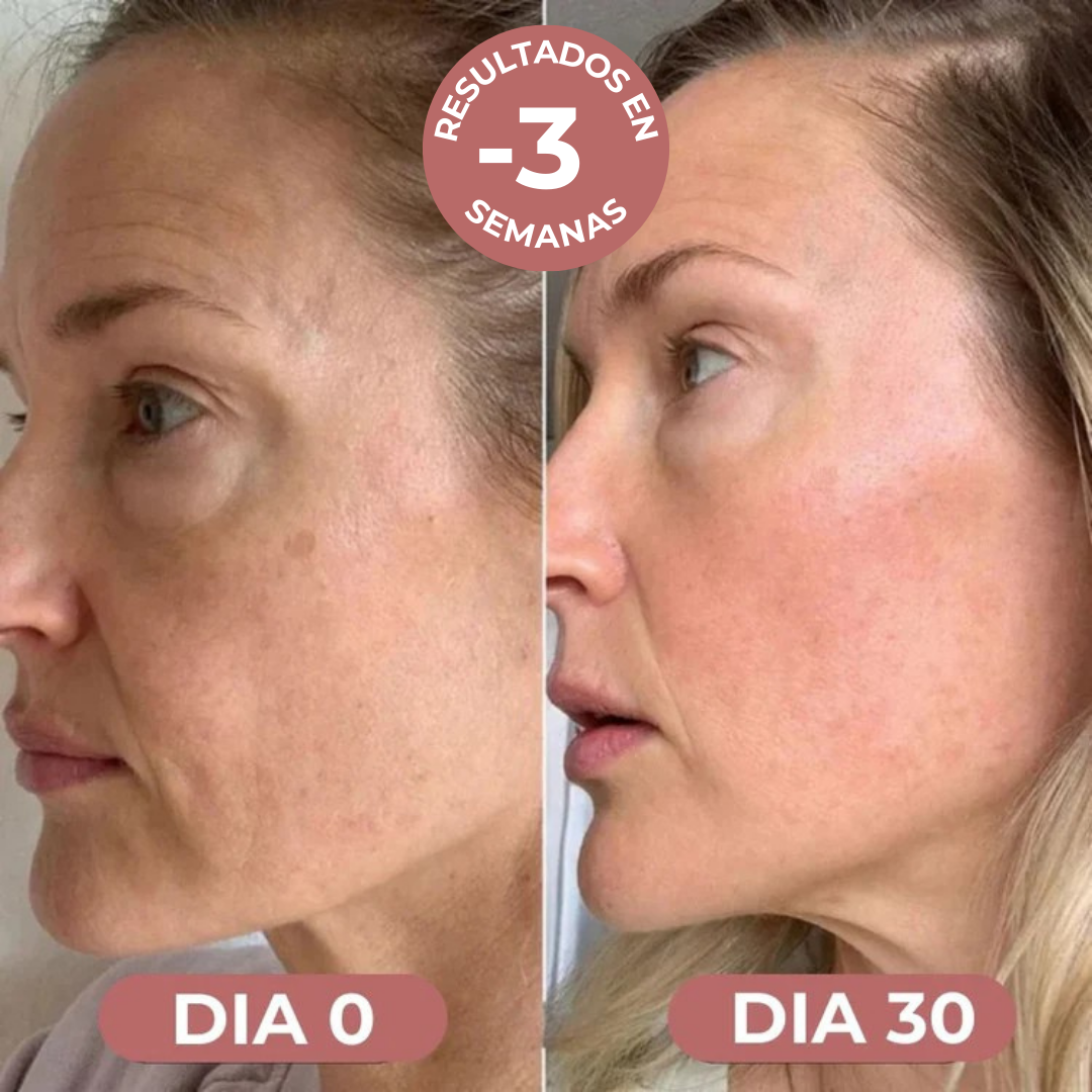 RejuveneClean: Parches Antiarrugas Reutilizables
