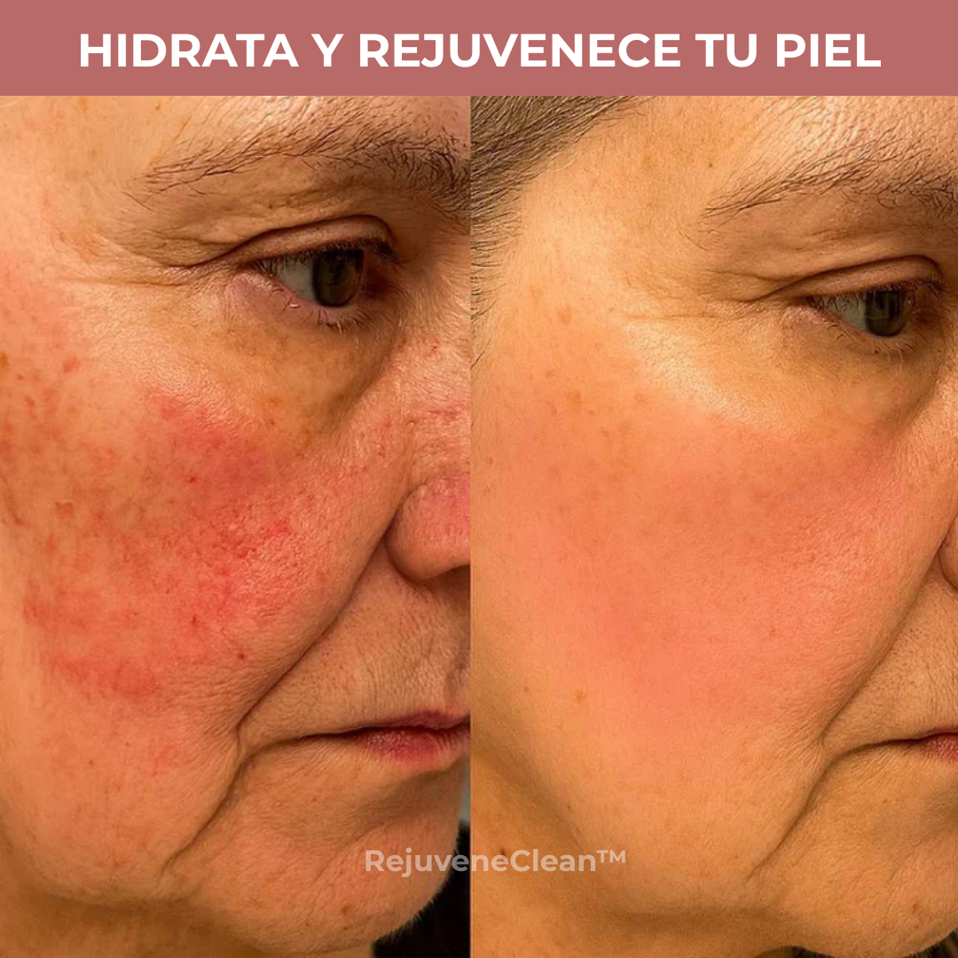 RejuveneClean: Parches Antiarrugas Reutilizables