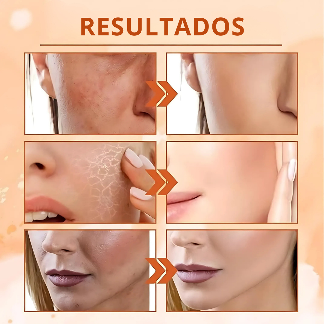 RadianceBoost™ – Tónico Facial Coreano con 5 Tipos de Vitamina C