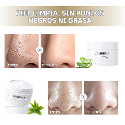 LANBENA Mascarilla Antipuntos Negros con Aloe Vera y Ácido Hialurónico