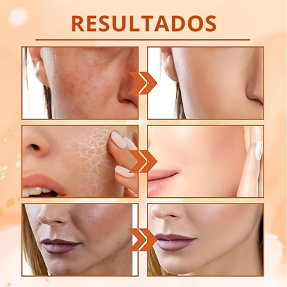 RadianceBoost™ – Tónico Facial Coreano con 5 Tipos de Vitamina C