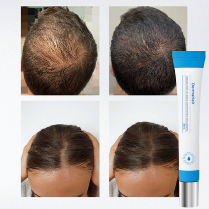 DermaHair: Serum Roll-on para crecimiento del cabello